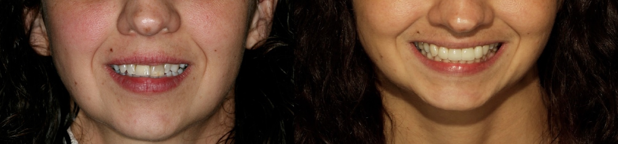 Dentist, Teeth Whitening, Cosmetic Dentistry, Restoration: Danbury, CT