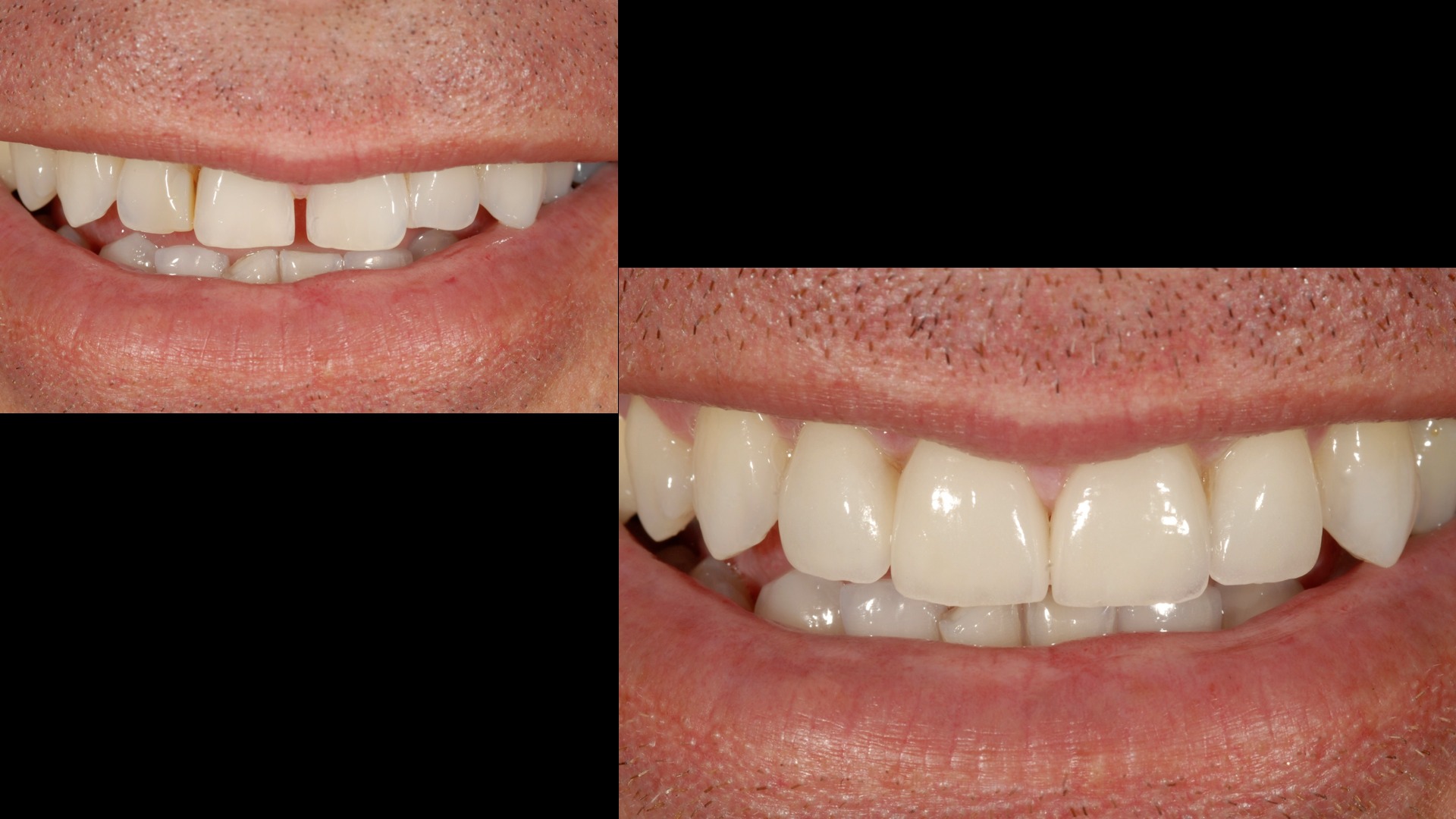 Dentist, Teeth Whitening, Cosmetic Dentistry, Restoration: Danbury, CT