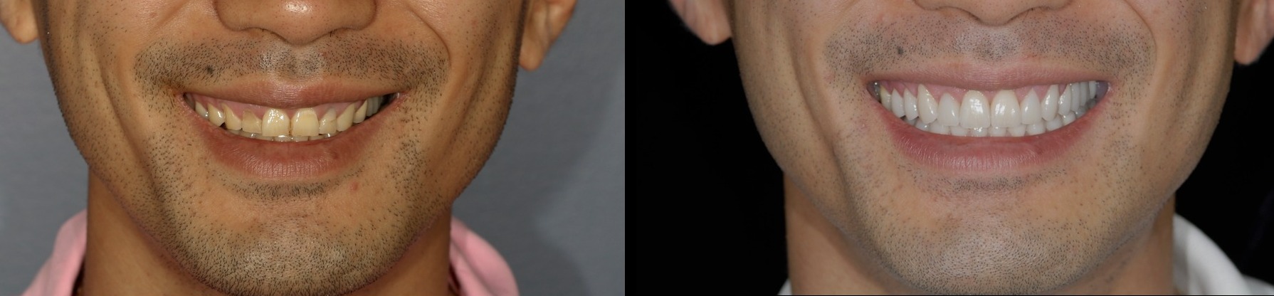 Dentist, Teeth Whitening, Cosmetic Dentistry, Restoration: Danbury, CT