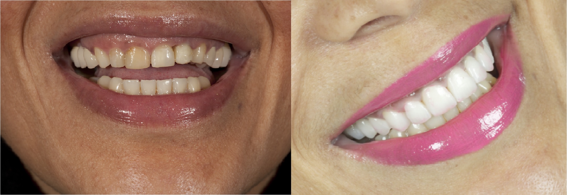 Dentist, Teeth Whitening, Cosmetic Dentistry, Restoration: Danbury, CT