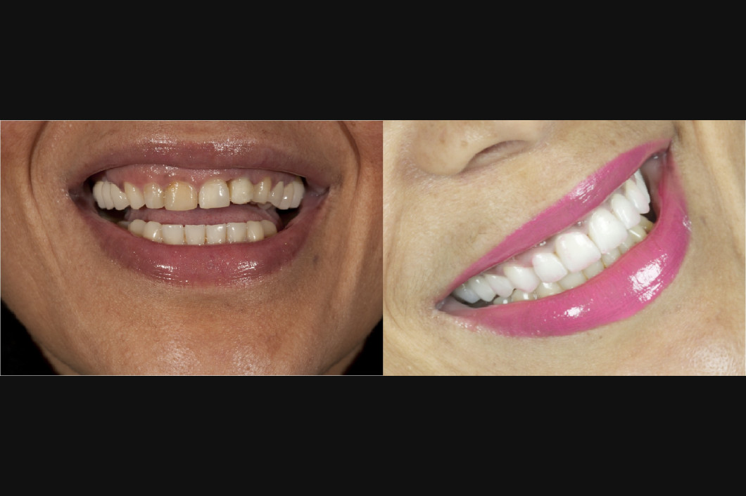 Dentist, Teeth Whitening, Cosmetic Dentistry, Restoration: Danbury, CT